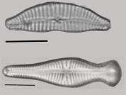 Diatomeas